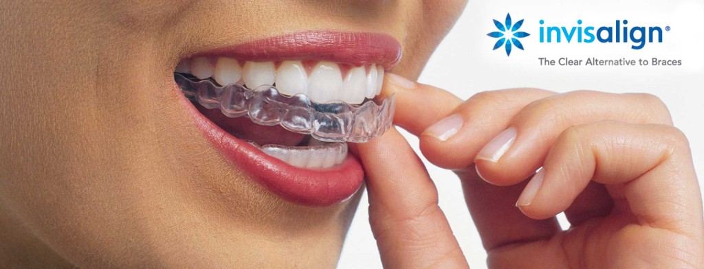Simply Orthodontics' Successful Tips with Invisalign