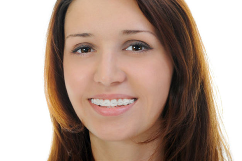 Are your teeth almost perfect?
