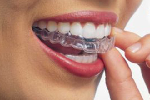 Simply Orthodontics' Successful Tips with Invisalign