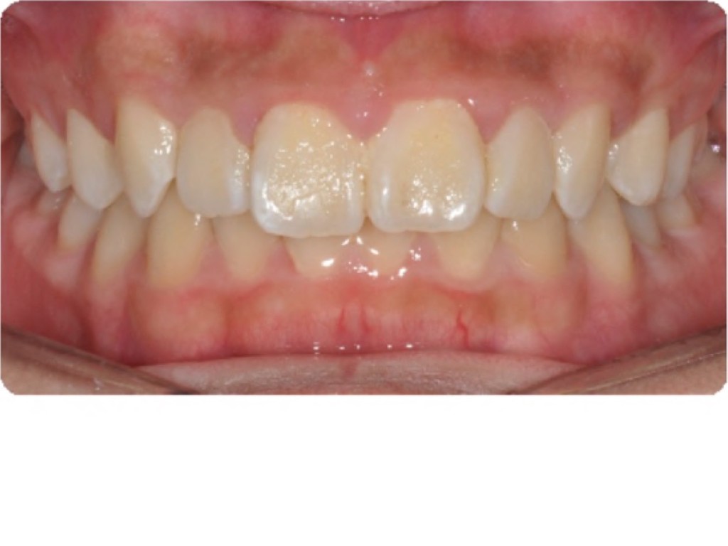 frontal-intraoral-photo2-1024x768