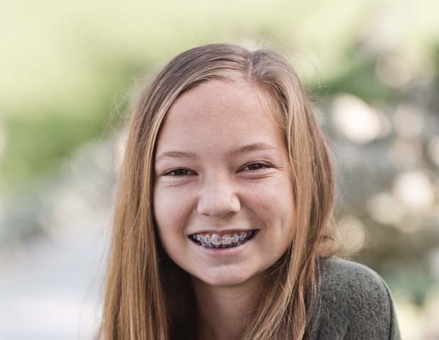Irvine Orthodontist Patient Feature: Chloe