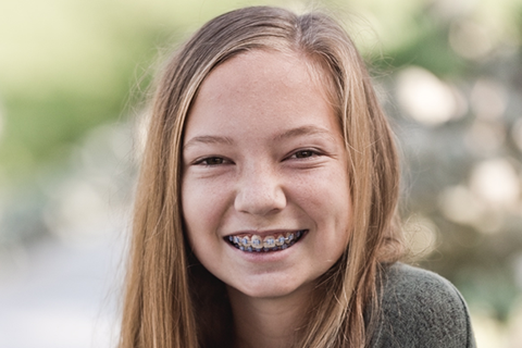 Irvine Orthodontist Patient Feature: Chloe