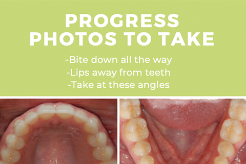 Taking Orthodontic Photos at Home
